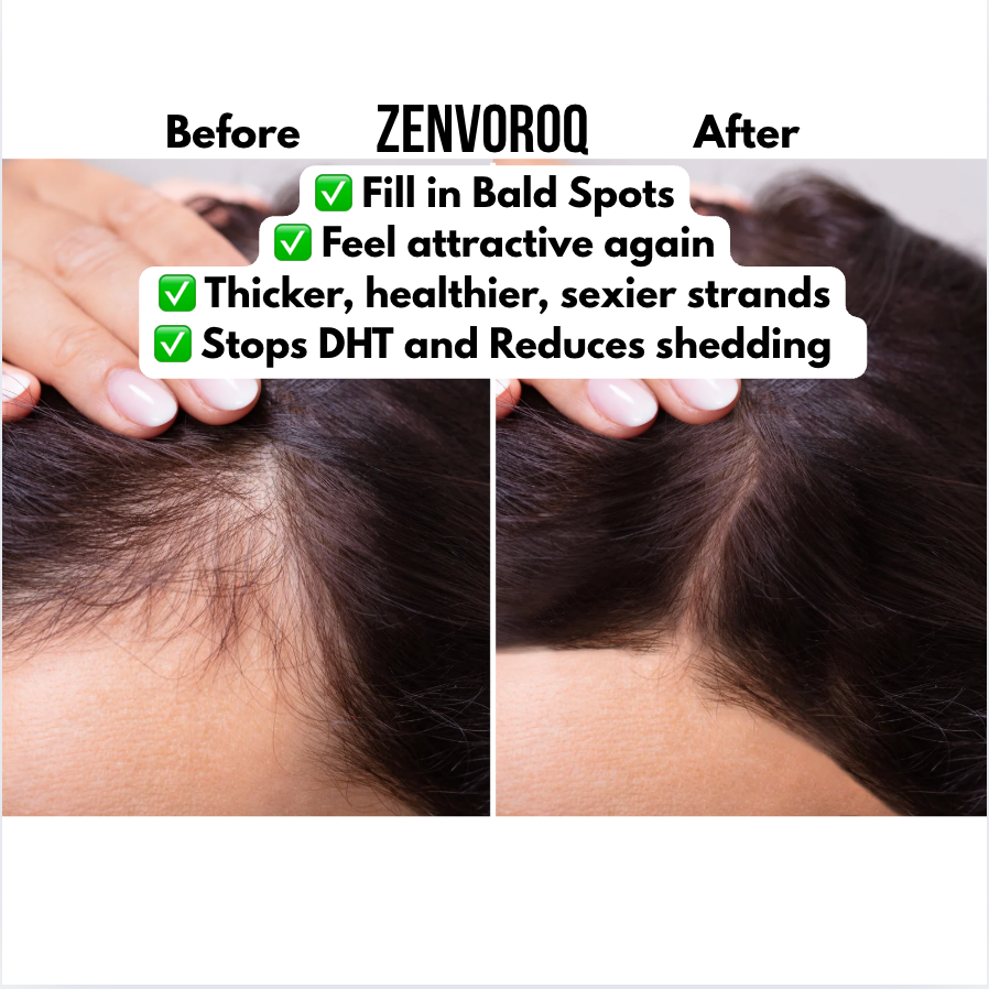 ZenvoroQ Natural Hair Serum